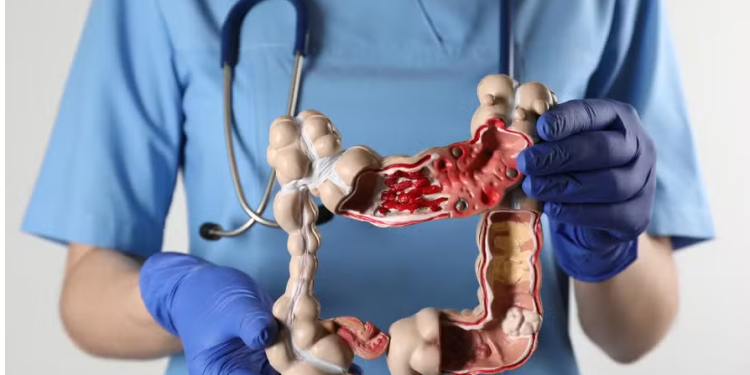 Sexto sentido intestinal? Estudo mostra como bactérias ‘falam’ com o cérebro