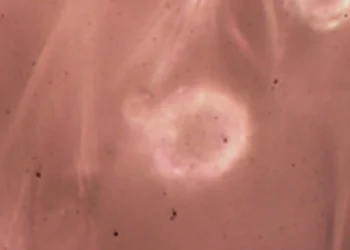 Pela 1ª vez no Brasil, cientistas acham microplástico em cordão umbilical