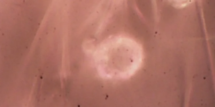 Pela 1ª vez no Brasil, cientistas acham microplástico em cordão umbilical